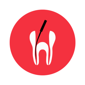 Endodontic treatment    