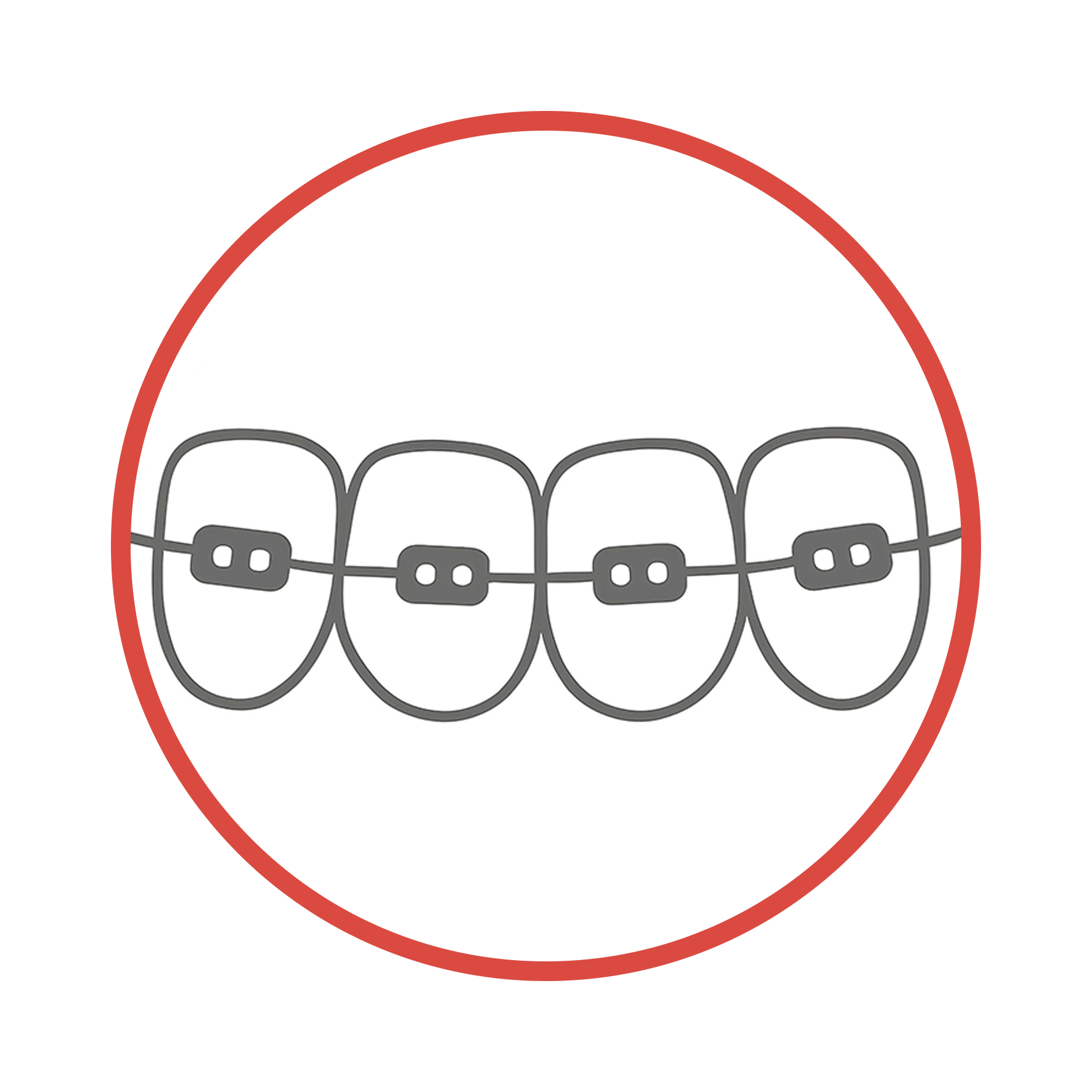 Orthodontic Therapy